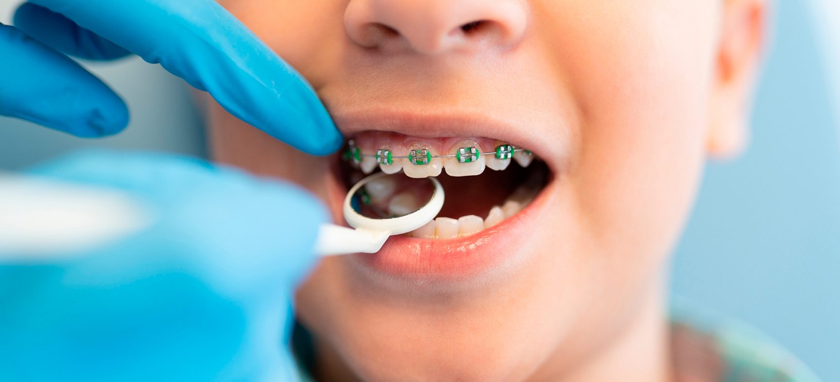 Cómo preparar a tu hijo para su primera visita al ortodoncista