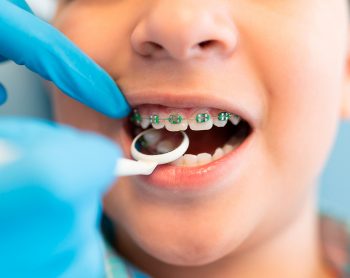 Cómo preparar a tu hijo para su primera visita al ortodoncista